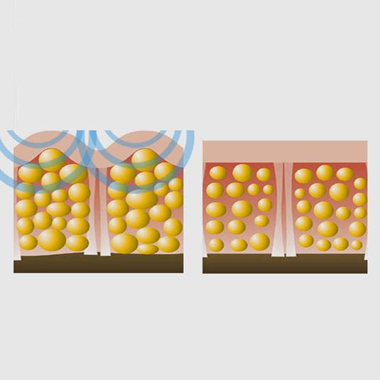 Byebye Buccia D Arancia